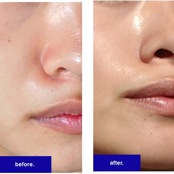 💦 MALIN + GOETZ RESURFACING FACE SERUM - Picture 14 of 14